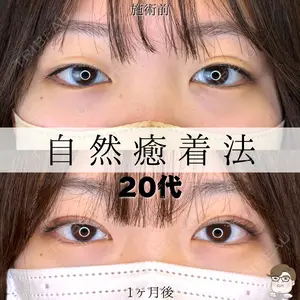 ルラ美容クリニック 札幌院 佐藤 雄紀医師の症例