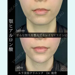 ルラ美容クリニック 札幌院 能登 貴弘医師の症例