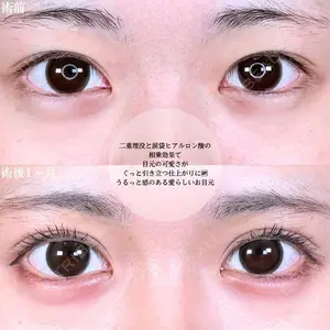 アリエル美容クリニック 大宮院 鈴木　桂介医師の症例