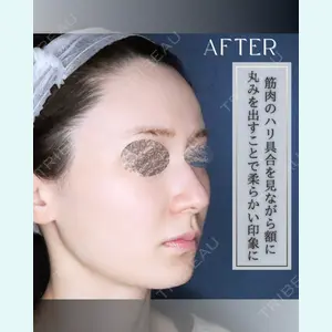 小倉美容外科/美容皮膚科 ビラビューティークリニック 大村 亞蘭医師の症例