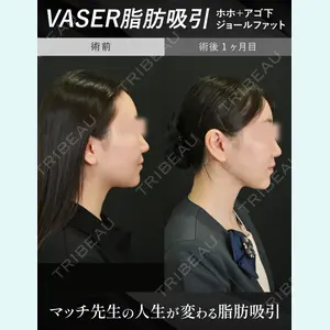 湘南美容クリニック 松戸院 小野聡真医師の症例