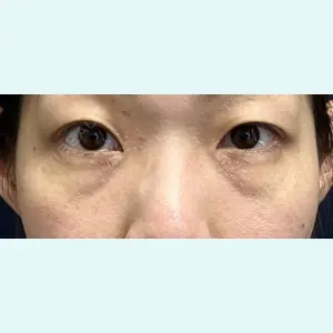 症例