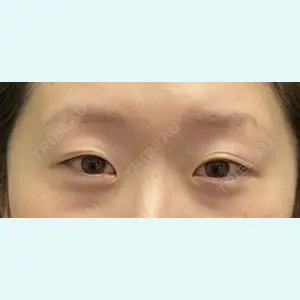 症例
