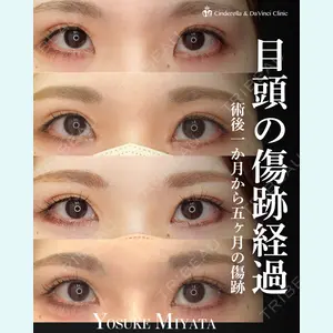 症例