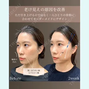 gift clinic 能登谷 翔医師の症例