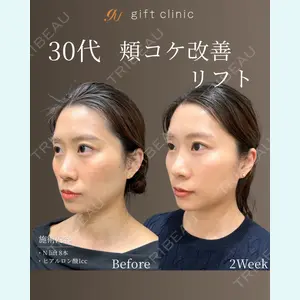 gift clinic 能登谷 翔医師の症例
