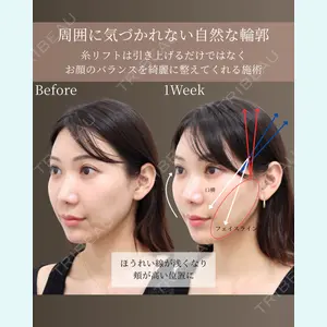 gift clinicの症例