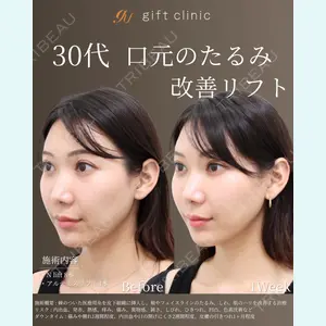 gift clinicの症例