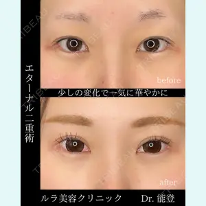 ルラ美容クリニック 札幌院 能登 貴弘医師の症例