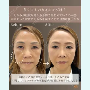 gift clinic 能登谷 翔医師の症例