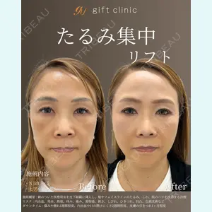gift clinic 能登谷 翔医師の症例