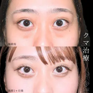 症例