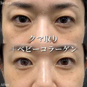症例