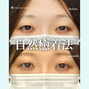症例