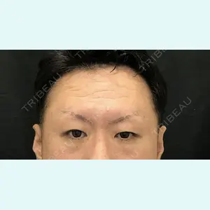 症例