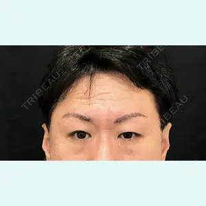 症例