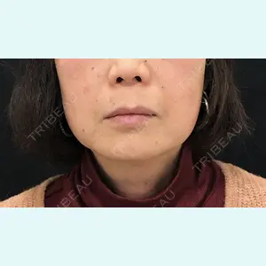 症例