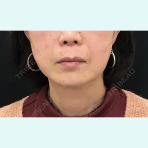 症例