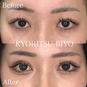 共立美容外科 渋谷院 磯野 智崇医師の症例