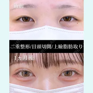 症例
