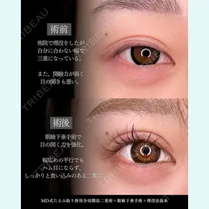 東京シンデレラ美容外科 新宿院 吉原 伯医師の症例