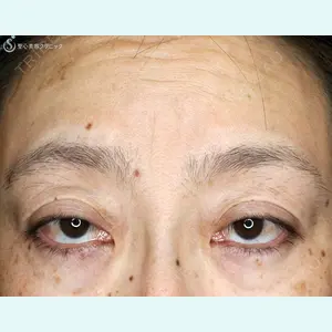 聖心美容クリニック 札幌院 前多 一彦医師の症例