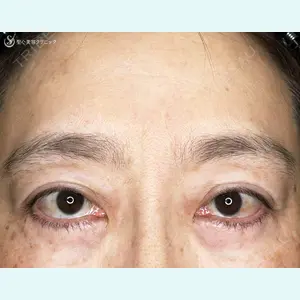 聖心美容クリニック 札幌院 前多 一彦医師の症例