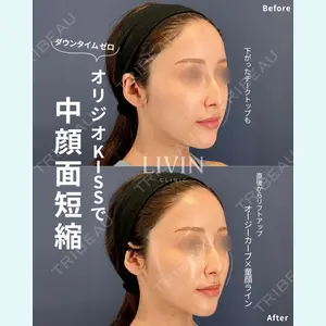 LIVIN CLINIC 新行内 芳明医師の症例