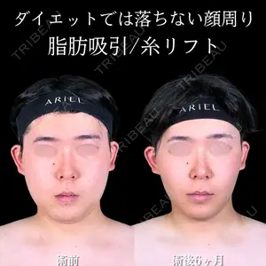 アリエル美容クリニック 大宮院 鈴木　桂介医師の症例