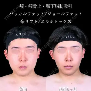 アリエル美容クリニック 大宮院 鈴木　桂介医師の症例