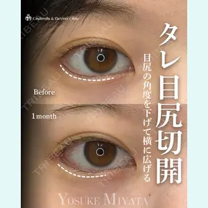 症例
