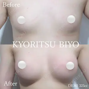 共立美容外科 渋谷院 磯野 智崇医師の症例