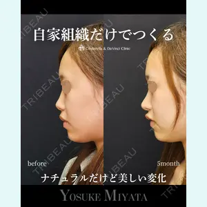症例