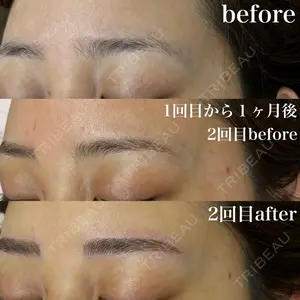 共立美容外科 熊本院の症例