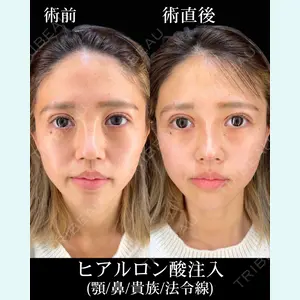 症例
