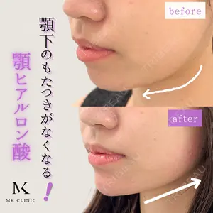 MKクリニック 日本橋院 石田雄太郎医師の症例