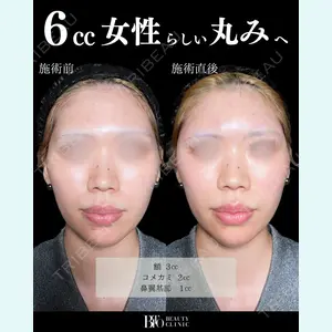 BITO BEAUTY CLINIC 伊藤 富良野医師の症例