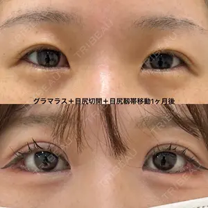エターナル美容クリニックの症例