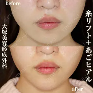 大塚美容形成外科 銀座本院 石井秀典医師の症例