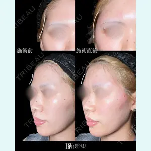 BITO BEAUTY CLINIC 伊藤 富良野医師の症例