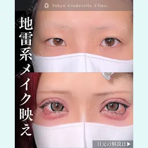 東京シンデレラ美容外科 新宿院 吉原 伯医師の症例