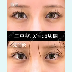 症例