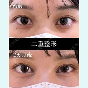 症例
