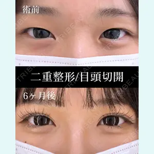 症例