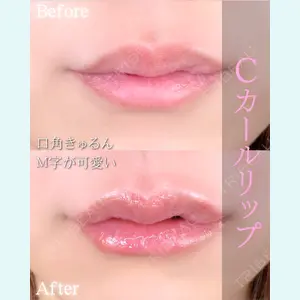 症例