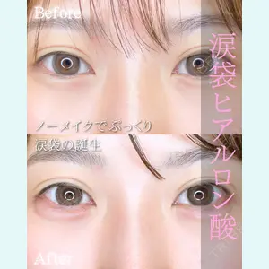症例
