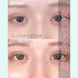 症例