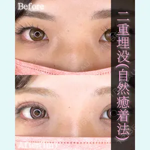 症例
