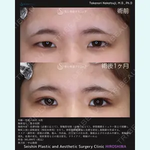 聖心美容クリニック 広島院 中辻 隆徳医師の症例