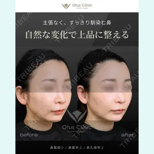 Otus Clinic 【オータスクリニック】 中 徳太郎医師の症例